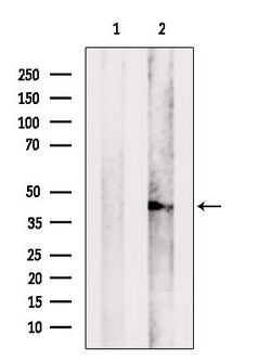 Invitrogen CCDC44 Polyclonal Antibody 100 &mu;L; Unconjugated:Antibodies,