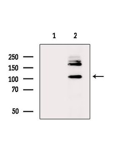 Invitrogen JIK Polyclonal Antibody 100 &mu;L | Buy Online | Invitrogen&trade; | Fisher Scientific