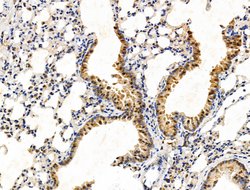 Invitrogen TBL1X Polyclonal Antibody 100 &mu;L; Unconjugated:Antibodies,