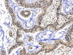 Invitrogen TBLR1 Polyclonal Antibody 100 μL; Unconjugated:Antibodies,