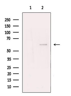 Invitrogen TBLR1 Polyclonal Antibody 100 μL; Unconjugated:Antibodies,