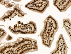 Invitrogen TBP Polyclonal Antibody 100 &mu;L | Buy Online | Invitrogen&trade; | Fisher Scientific