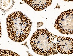Invitrogen TBP Polyclonal Antibody 100 &mu;L | Buy Online | Invitrogen&trade; | Fisher Scientific