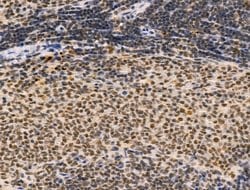 Invitrogen TBP Polyclonal Antibody 100 &mu;L | Buy Online | Invitrogen&trade; | Fisher Scientific