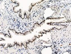 Invitrogen TBP Polyclonal Antibody 100 &mu;L | Buy Online | Invitrogen&trade; | Fisher Scientific