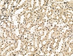 Invitrogen TBP Polyclonal Antibody 100 &mu;L | Buy Online | Invitrogen&trade; | Fisher Scientific
