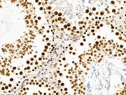 Invitrogen TBP Polyclonal Antibody 100 &mu;L | Buy Online | Invitrogen&trade; | Fisher Scientific