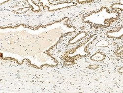 Invitrogen TBP Polyclonal Antibody 100 &mu;L | Buy Online | Invitrogen&trade; | Fisher Scientific