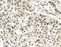 Invitrogen TBP Polyclonal Antibody 100 &mu;L | Buy Online | Invitrogen&trade; | Fisher Scientific
