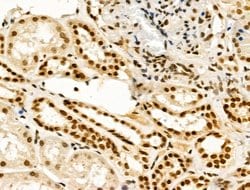 Invitrogen TBP Polyclonal Antibody 100 &mu;L | Buy Online | Invitrogen&trade; | Fisher Scientific