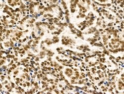 Invitrogen TBP Polyclonal Antibody 100 &mu;L | Buy Online | Invitrogen&trade; | Fisher Scientific