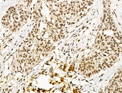 Invitrogen TBP Polyclonal Antibody 100 &mu;L | Buy Online | Invitrogen&trade; | Fisher Scientific