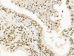 Invitrogen TBP Polyclonal Antibody 100 &mu;L | Buy Online | Invitrogen&trade; | Fisher Scientific