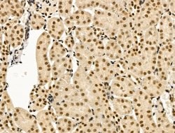 Invitrogen TBP Polyclonal Antibody 100 &mu;L | Buy Online | Invitrogen&trade; | Fisher Scientific