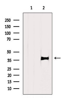 Invitrogen TBP Polyclonal Antibody 100 &mu;L | Buy Online | Invitrogen&trade; | Fisher Scientific