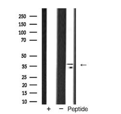 Invitrogen TBP Polyclonal Antibody 100 &mu;L | Buy Online | Invitrogen&trade; | Fisher Scientific