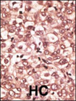 Invitrogen TLR6 Polyclonal Antibody 400 &mu;L; Unconjugated:Antibodies,