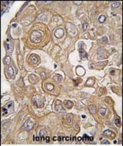 Invitrogen TLR6 Polyclonal Antibody 400 &mu;L; Unconjugated:Antibodies,
