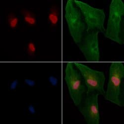 Invitrogen TBX2/3 Polyclonal Antibody 100 &mu;L; Unconjugated:Antibodies,