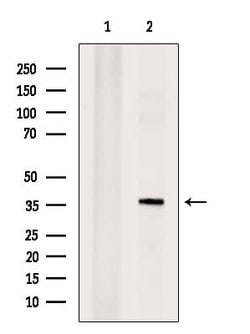Invitrogen TCF21 Polyclonal Antibody 100 &mu;L; Unconjugated:Antibodies,