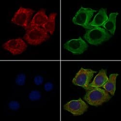 Invitrogen Cripto Polyclonal Antibody 100 &mu;L; Unconjugated:Antibodies,