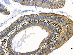 Invitrogen Cripto Polyclonal Antibody 100 &mu;L; Unconjugated:Antibodies,