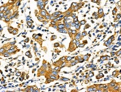 Invitrogen Cripto Polyclonal Antibody 100 &mu;L; Unconjugated:Antibodies,