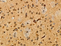 Invitrogen Cripto Polyclonal Antibody 100 &mu;L; Unconjugated:Antibodies,