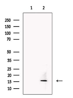 Invitrogen TECK Polyclonal Antibody 100 &mu;L; Unconjugated:Antibodies,