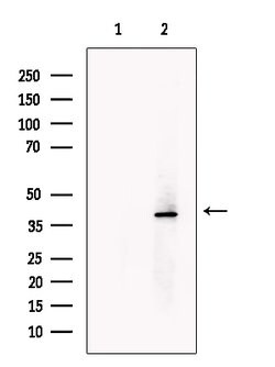 Invitrogen TNMD Polyclonal Antibody 100 &mu;L; Unconjugated:Antibodies,