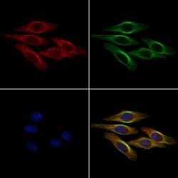 Invitrogen Tensin 1 Polyclonal Antibody 100 &mu;L | Buy Online | Invitrogen&trade; | Fisher Scientific