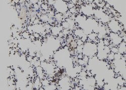 Invitrogen TET2 Polyclonal Antibody 100 μL; Unconjugated:Antibodies,