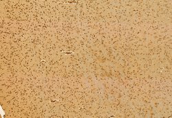 Invitrogen TET2 Polyclonal Antibody 100 μL; Unconjugated:Antibodies,