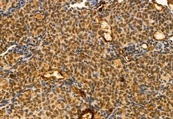 Invitrogen TET2 Polyclonal Antibody 100 μL; Unconjugated:Antibodies,