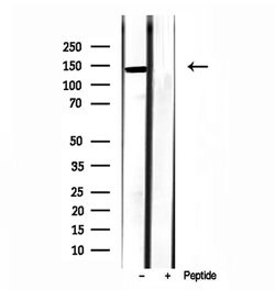 Invitrogen TET2 Polyclonal Antibody 100 μL; Unconjugated:Antibodies,