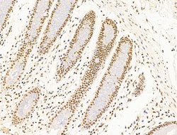Invitrogen TFAP4 Polyclonal Antibody 100 &mu;L; Unconjugated:Antibodies,