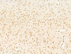 Invitrogen TFAP4 Polyclonal Antibody 100 &mu;L; Unconjugated:Antibodies,