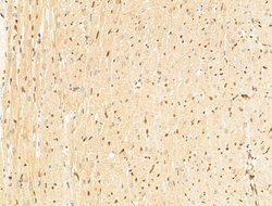 Invitrogen TFAP4 Polyclonal Antibody 100 &mu;L; Unconjugated:Antibodies,