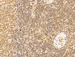 Invitrogen TFAP4 Polyclonal Antibody 100 &mu;L; Unconjugated:Antibodies,
