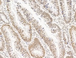 Invitrogen TFAP4 Polyclonal Antibody 100 &mu;L; Unconjugated:Antibodies,