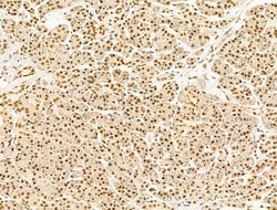 Invitrogen TFAP4 Polyclonal Antibody 100 &mu;L; Unconjugated:Antibodies,