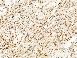 Invitrogen TFAP4 Polyclonal Antibody 100 &mu;L; Unconjugated:Antibodies,