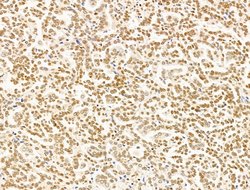 Invitrogen TFAP4 Polyclonal Antibody 100 &mu;L; Unconjugated:Antibodies,