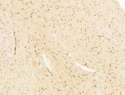Invitrogen TFAP4 Polyclonal Antibody 100 &mu;L; Unconjugated:Antibodies,