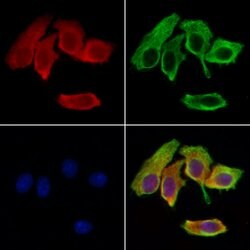 Invitrogen TMSB10 Polyclonal Antibody 100 &mu;L; Unconjugated:Antibodies,