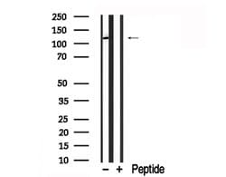 CD202b (TIE2) Polyclonal Antibody:Antibodies, Polyclonal