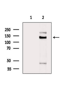 Invitrogen TIMELESS Polyclonal Antibody 100 &mu;L; Unconjugated:Antibodies,