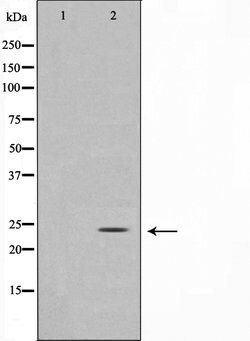 Invitrogen TIMP3 Polyclonal Antibody 100 &mu;L | Buy Online | Invitrogen&trade; | Fisher Scientific