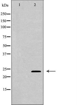 Invitrogen TIMP3 Polyclonal Antibody 100 &mu;L; Unconjugated:Antibodies,