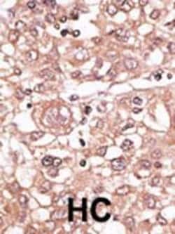 Invitrogen TLR7 Polyclonal Antibody 400 &mu;L; Unconjugated:Antibodies,